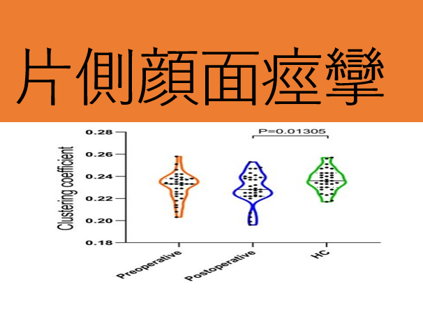 片側顔面痙攣の拡散テンソルイメージ 自由が丘 清澤眼科