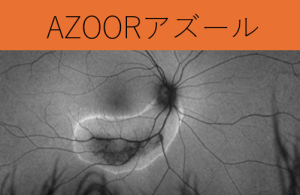 azoor アズールについて再度説明してみましょう： | 自由が丘 清澤眼科